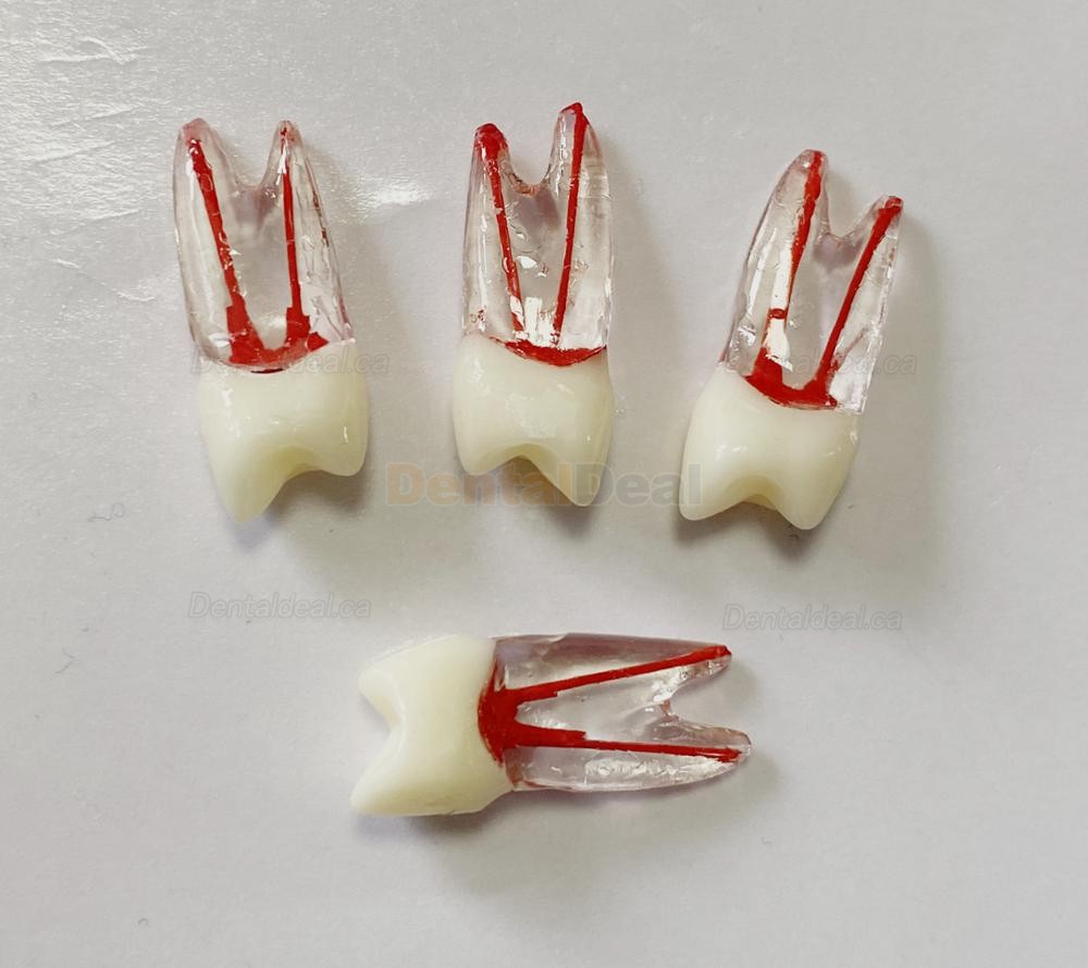 Dental Teeth Practice Model Endo File Molar Upper Lower Tooth Premolar Root 2/3-Rooted Canal